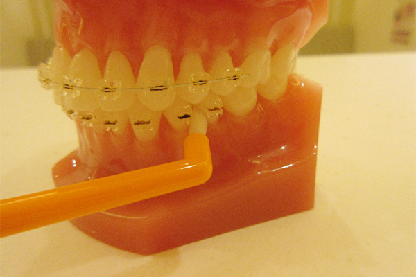 歯の隙間や奥歯の届きにくいところ