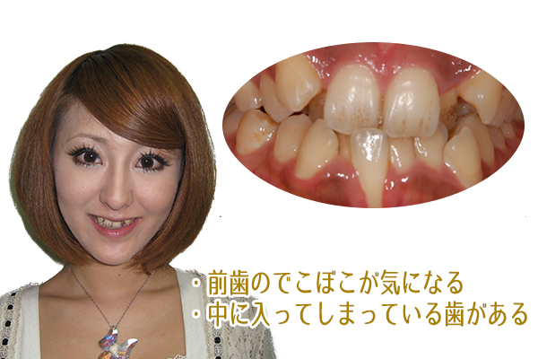 お悩み