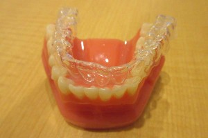 マウスピース矯正のお手入れの方法