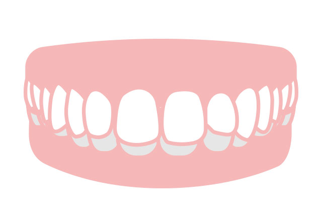 上の歯の大きさが大きめのタイプ
